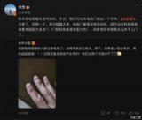 一網(wǎng)友被電吸門(mén)夾手 李想在微博在線(xiàn)支招